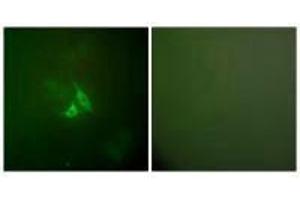 Immunofluorescence analysis of A549 cells, using Cox2 antibody. (PTGS2 anticorps)