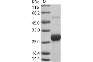 Western Blotting (WB) image for Bundibugyo Ebola Virus Envelope Glycoprotein (BEBOV VP24) protein (His tag) (ABIN7198903) (BEBOV VP24 Protein (His tag))