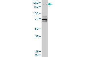 HELZ monoclonal antibody (M02), clone 5B2 Western Blot analysis of HELZ expression in Hela S3 NE .