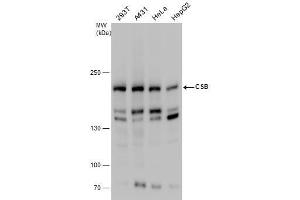 WB Image CSB antibody detects CSB protein by western blot analysis. (ERCC6 anticorps  (Internal Region))