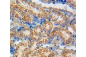 IHC-P analysis of Kidney tissue, with DAB staining. (GAS6 anticorps  (AA 59-221))