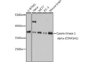 Western blot analysis of extracts of various cell lines, using Casein Kinase 1 alpha (Casein Kinase 1 alpha (CSNK1)) antibody (6225) at 1:1000 dilution. (CSNK1A1 anticorps  (AA 100-200))