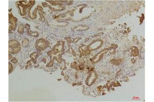 Immunohistochemistry (IHC) analysis of paraffin-embedded Human Prostate Tissue using Endothelin B Receptor Rabbit Polyclonal Antibody diluted at 1:200. (EDNRB anticorps)