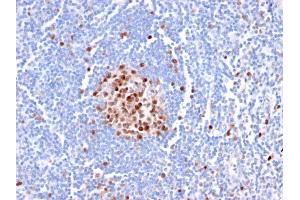 Formalin-fixed, paraffin-embedded human Tonsil stained with PCNA Mouse Monoclonal Antibody (PC5).