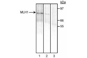 Immunoprecipitation of MLH1. (MLH1 anticorps)