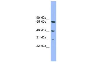 WB Suggested Anti-Rfxap Antibody Titration: 0. (RFXAP anticorps  (N-Term))