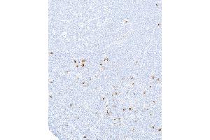 Immunohistochemistry (IHC) image for anti-Interleukin 2 Receptor, alpha (IL2RA) (AA 222-272) antibody (ABIN7448898)
