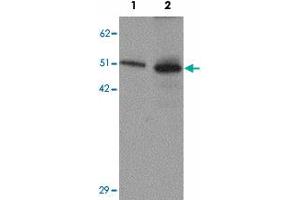 Western blot analysis of SLC39A7 in mouse brain tissue lysate with SLC39A7 polyclonal antibody  at (1) 0. (SLC39A7 anticorps  (N-Term))