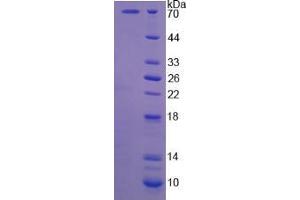 Image no. 1 for Calpain 5 (CAPN5) (AA 2-344) protein (His tag,GST tag) (ABIN6239618)