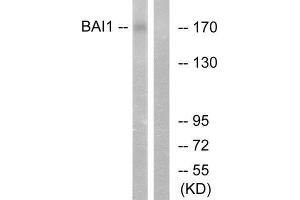 Western Blotting (WB) image for anti-Brain-Specific Angiogenesis Inhibitor 1 (BAI1) (Internal Region) antibody (ABIN6301192) (BAI1 anticorps  (Internal Region))