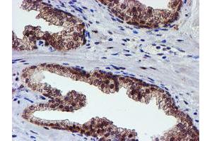 Image no. 11 for anti-Proteasome (Prosome, Macropain) 26S Subunit, Non-ATPase, 2 (PSMD2) antibody (ABIN1500479)