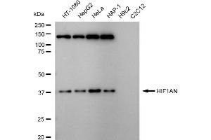 Western blotting analysis using HIF1AN antibody (ABIN7799018).