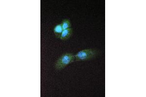 IF analysis of Abhd5 using anti-Abhd5 antibody (ABIN4886411).