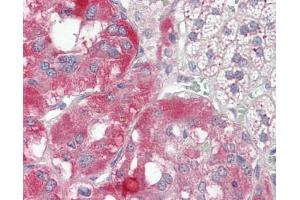 Image no. 1 for anti-ATPase, H+ Transporting, Lysosomal Accessory Protein 2 (ATP6AP2) (AA 146-320) antibody (ABIN467627)