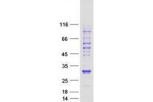 Validation with Western Blot