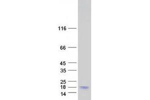 Validation with Western Blot