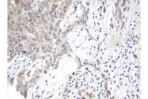 Image no. 1 for anti-ADP-Ribosylation Factor-Like 2 Binding Protein (ARL2BP) antibody (ABIN1496716)