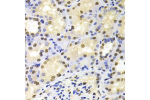 Immunohistochemistry of paraffin-embedded human kidney using HDGF Antibody (ABIN1876535) at dilution of 1:100 (40x lens). (HDGF anticorps)