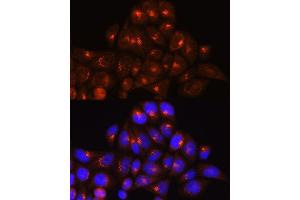 Immunofluorescence analysis of HeLa cells using GOLG Rabbit pAb (ABIN6129790, ABIN6141266, ABIN6141267 and ABIN6214379) at dilution of 1:100 (40x lens).