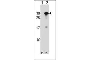 Western blot analysis of RYBP (arrow) using RYBP Antibody (N-term) Cat. (RYBP anticorps  (N-Term))