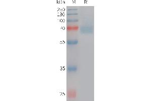 Human ACHE Protein, His Tag on SDS-PAGE under reducing condition.