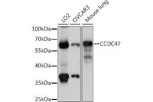 Western blot analysis of extracts of various cell lines, using CCDC47 antibody (ABIN7266438) at 1:1000 dilution. (CCDC47 anticorps  (AA 224-483))