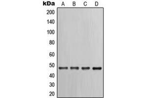 Western blot analysis of Cytokeratin 17 expression in PC12 (A), HeLa (B), A431 (C), NIH3T3 (D) whole cell lysates. (KRT17 anticorps  (C-Term))