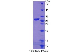 SDS-PAGE analysis of Human RND1 Protein. (RND1 Protéine)