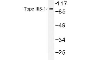 Image no. 1 for anti-Topoisomerase (DNA) III beta (TOP3B) antibody (ABIN272153) (TOP3B anticorps)