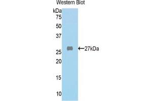 WB of Protein Standard: different control antibodies against Highly purified E.