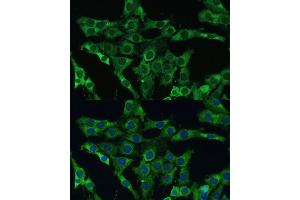 anti-phospholipid Scramblase 3 (PLSCR3) (AA 1-295) antibody