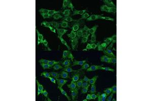 Immunofluorescence analysis of C6 cells using PLSCR3 Polyclonal Antibody (ABIN6132499, ABIN6145798, ABIN6145799 and ABIN6215981) at dilution of 1:100 (40x lens).