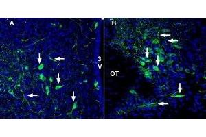 Expression of VNUT (SLC17A9) in rat hypothalamus - Immunohistochemical staining of perfusion-fixed frozen rat brain sections with Anti-SLC17A9 Antibody (ABIN7043685, ABIN7044827 and ABIN7044828), (1:2000), followed by goat anti-rabbit-AlexaFluor-488.