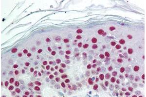 Human Skin (formalin-fixed, paraffin-embedded) stained with SET antibody ABIN297641 at 10 ug/ml followed by biotinylated goat anti-rabbit IgG secondary antibody ABIN481713, alkaline phosphatase-streptavidin and chromogen. (SET/TAF-I anticorps  (AA 66-81))
