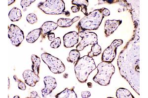 IHC analysis of Calpastatin using anti-Calpastatin antibody .