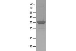 Western Blotting (WB) image for Family With Sequence Similarity 119A (FAM119A) (AA 93-218) protein (His-IF2DI Tag) (ABIN7122873)