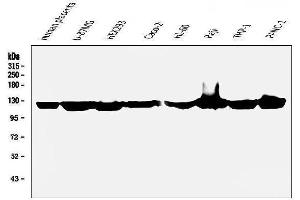 Western blot analysis of ATP citrate lyase using anti-ATP citrate lyase antibody (ABIN6719406).