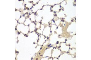 Immunohistochemistry (IHC) image for anti-Estrogen Receptor 2 (ESR2) (AA 1-280) antibody (ABIN6219642) (ESR2 anticorps  (AA 1-280))