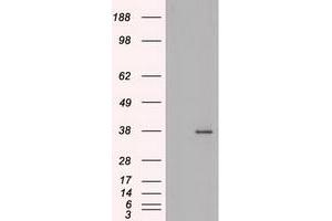HEK293T cells were transfected with the pCMV6-ENTRY control (Left lane) or pCMV6-ENTRY BFGF (RC217426) (Right lane) cDNA for 48 hrs and lysed. (FGF2 anticorps  (AA 10-155))