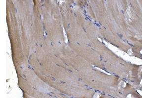 IHC analysis of PAK2 using anti-PAK2 antibody (ABIN7599219). (PAK2 anticorps  (AA 1-288))