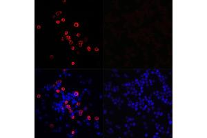 Immunofluorescence analysis of 293T cells transfected with SARS-CoV-2 3CLpro fusion protein (top left) and untreated 293T cells (top right) use SARS-CoV-2 3CLpro Rabbit pAb (ABIN7270151) at dilution of 1:100 (40x lens).