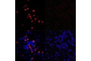 Immunofluorescence analysis of 293T cells transfected with SARS-CoV-2 3CLpro fusion protein (top left) and untreated 293T cells (top right) use SARS-CoV-2 3CLpro Rabbit pAb (ABIN7270151) at dilution of 1:100 (40x lens).