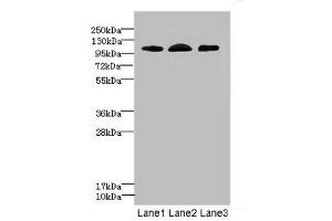 Western blot All lanes: EPHB4 antibody at 2.