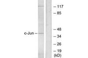 Western blot analysis of extracts from HeLa cells, using c-Jun (Ab-73) Antibody. (C-JUN anticorps  (AA 40-89))