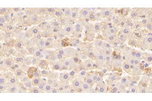 Detection of LEPR in Rat Liver Tissue using Polyclonal Antibody to Leptin Receptor (LEPR)