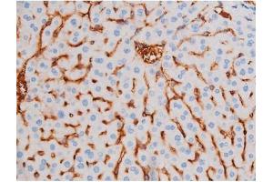 ABIN6267484 at 1/200 staining Mouse liver tissue sections by IHC-P.