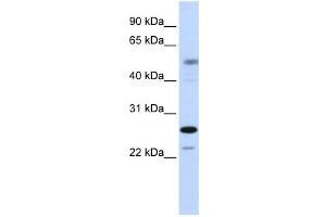 Western Blotting (WB) image for anti-PSMC3 Interacting Protein (PSMC3IP) antibody (ABIN2459129) (PSMC3IP anticorps)