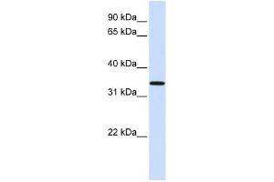 C16ORF78 antibody used at 1 ug/ml to detect target protein. (C16orf78 anticorps  (Middle Region))