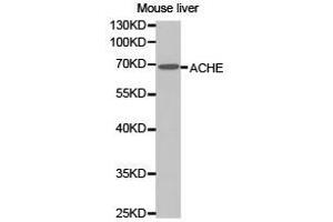 Western Blotting (WB) image for anti-Acetylcholinesterase (AChE) antibody (ABIN1870760) (Acetylcholinesterase anticorps)