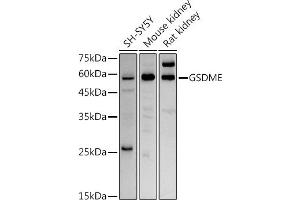 Western blot analysis of extracts of various cell lines, using GSDME antibody (ABIN6127757, ABIN6139554, ABIN6139555 and ABIN6223304) at 1:1000 dilution. (Non-Syndromic Hearing Impairment Protein 5 (GSDME) (AA 1-260) anticorps)
